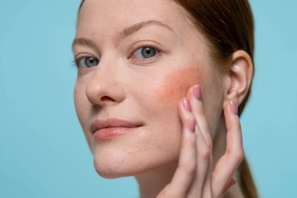 Dermatitis de contacto por fragancias: cómo se identifica al responsable